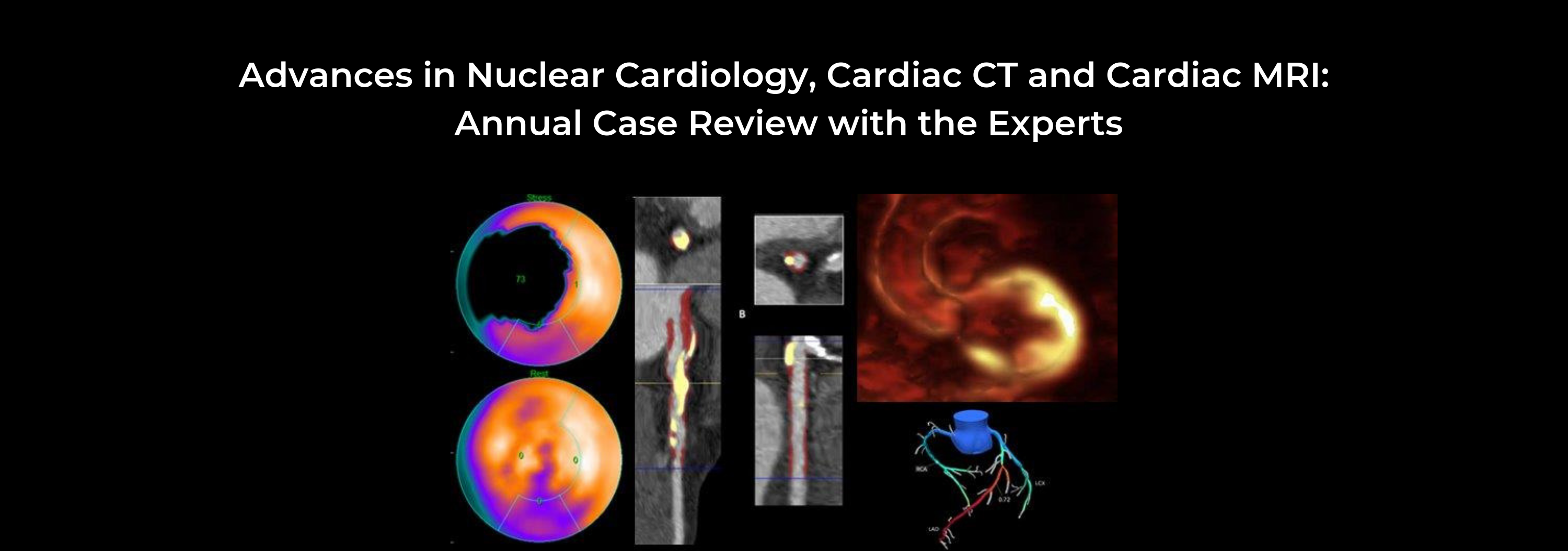 Advances in Nuclear Cardiology, Cardiac CT and Cardiac MRI: 35th Annual Case Review with the Experts Banner